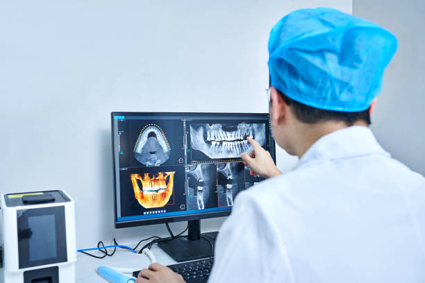 Best Emergency Root Canal Treatment in Dublin, CA